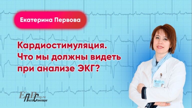 Кардиостимуляция. Что мы должны видеть при анализе ЭКГ?