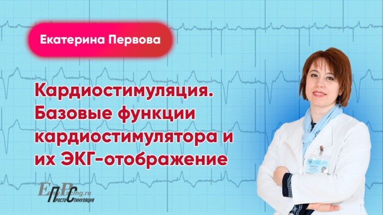 Кардиостимуляция. Базовые функции кардиостимулятора и их ЭКГ-отображение